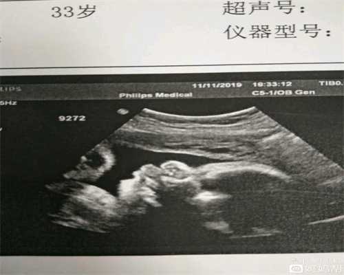深圳嘉乐生殖医院,孕期头晕可不能就这么挺过去