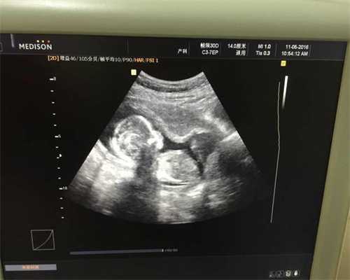 深圳人工受孕需要,南方国际广场深圳,怀孕后不能
