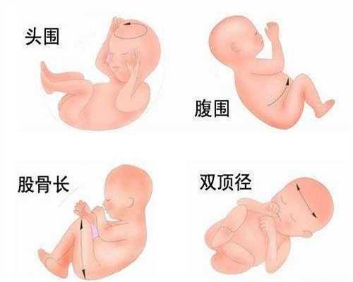 深圳代孕包成功套餐,关乎胎儿健康，孕期这些检