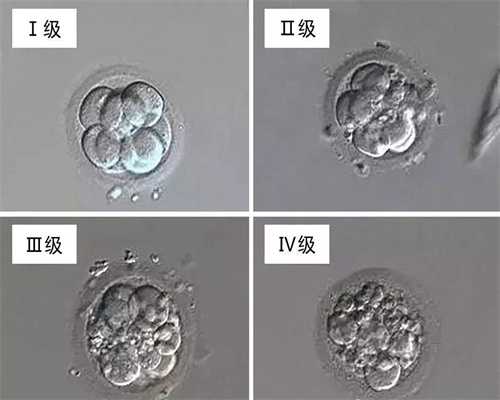 北京代孕产子什么意思_孕期胎心不稳的5大原因！