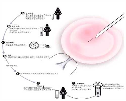 北京价格低的代孕医院_顺产和剖腹产，哪个对产妇身体的伤害更大？