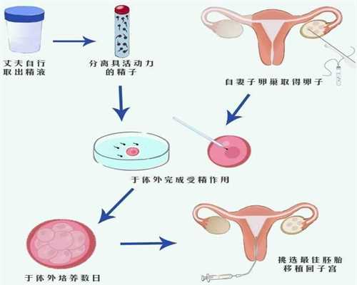 北京代孕包成功收费标准_多囊卵巢还能受孕吗