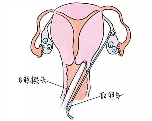 北京代孕包生孩子多少钱_打生长激素月经会停吗