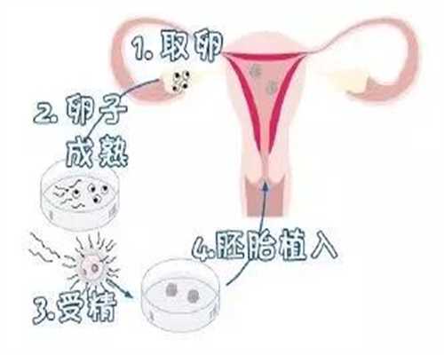 北京代孕年龄限制_高龄孕妇不能做唐筛吗