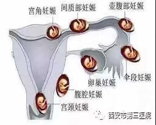 北京谁有代孕群的号码_人流之后多久来月经属正常