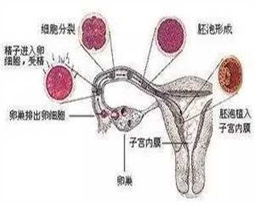 北京正规的代孕机构_宫外孕怎么治疗?
