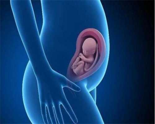 代怀孕_孕期卵巢畸胎瘤怎么办