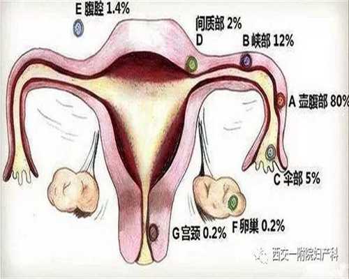 北京中国正规规孕机构_老人要注意保养身体的“四梢”