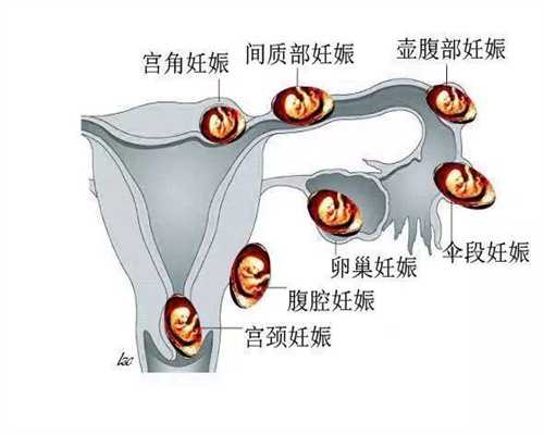 北京代孕产子网`北京代孕网服务`北京代孕移植后反应