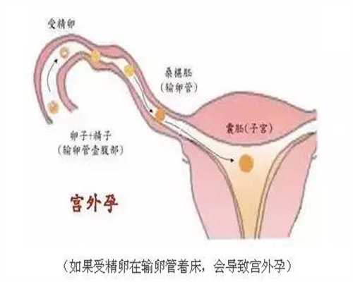 北京代孕医院-北京做试管代孕过程-胎盘前置状态能上班吗