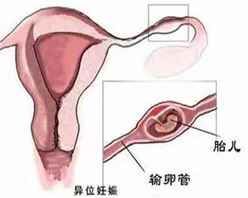 |深圳代生儿子中心：从古代优生学看怀孕禁忌