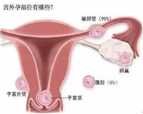 深圳代生男孩生殖：7大孕早期症状全解析,你中了几条？